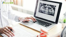 名家專用／NOW健康／「牙醫黑科技」不僅應用於植牙，也包括牙齒美白貼片、改善笑齦等，高科技、快速、可預覽及3D列印，提高術後滿意度。(勿用)