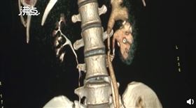 圖／翻攝自沸點視頻