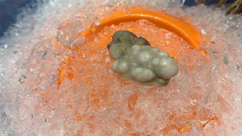 男吃鍋蚵仔竟冒12顆腫瘤　真相曝光