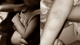 單親媽,幼童,雇主,老闆,金錢糾紛,驗傷,凌虐,台中