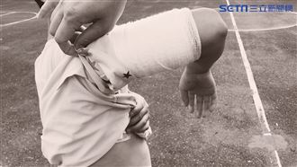 國小生被燒「全身火」　嬤氣炸求真相