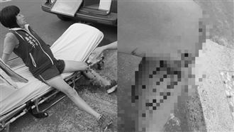 彰化女里長腿遭浪浪撕咬　噴血倒地傷