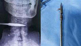 黃男捕魚時，不慎將鏢槍射進自己的脖子。（圖／翻攝自《光明報》） 