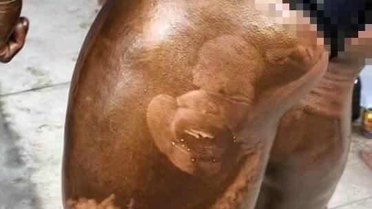 健美男大腿驚見清晰人臉　真相笑翻網