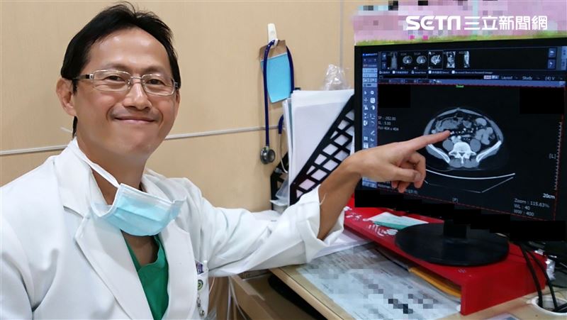 媽4年前確診大腸癌　三兄弟接連發病