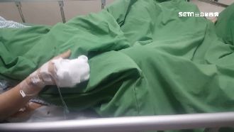 手指燒焦恐截肢　家屬控醫院照顧不當