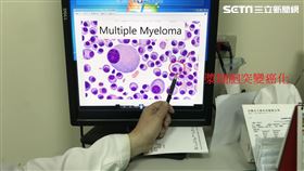 醫警覺揪出多發性骨髓瘤　69歲男逃過終身洗腎（圖／烏日林新醫院提供）