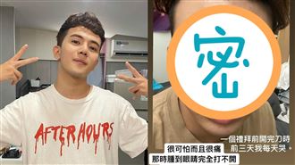 孫生半臉膨脹變形　床上狂抽搐要人壓