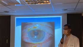 書田診所眼科副院長廖士傑表示，乾眼症是眼科門診常見的問題，盛行率約30％。（圖／記者簡浩正攝影）