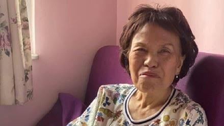 病況好轉　83歲最醜女星肺部沒惡化