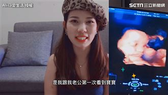 兩岸產檢差異大　她：來台才看到寶寶