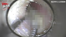  ▲耳垢體積太大，長時間會有堵塞耳道的問題。（圖／社群中心提供）