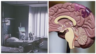 陽光男腦瘤「長在這」　醫師想救無能為力