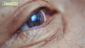 名家專用／NOW健康／眼科醫師陳逸川表示，現今已經能以微創手術治療白內障，加上人工水晶體不斷改良，能依照患者需求選擇不同的功能，相當進步且人性化。(勿用)