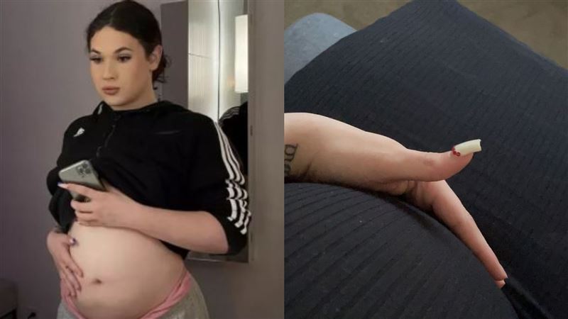 男啪啪後覺得怪　就醫發現自己有子宮