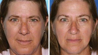 他2招打趴癌症　曝哈佛大學回春秘密