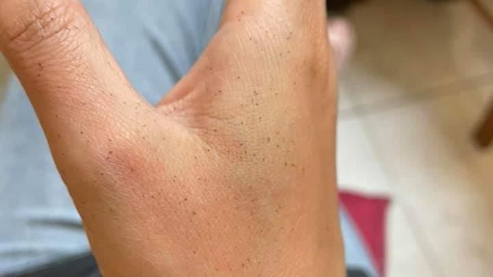過馬路被瀝青慘噴　網曝廚房一物清除