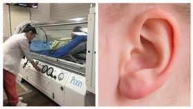 突然失聰恐是耳中風　把握7天治療期（南投醫院提供）