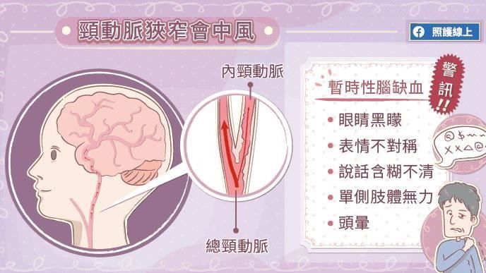 暈眩、眼睛黑矇小心！恐是中風前兆