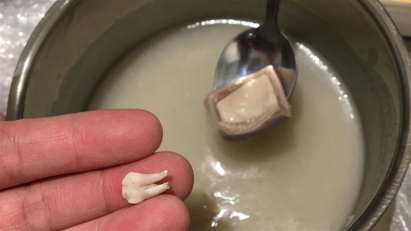 四神湯喝到一顆牙齒　男歌手：不是人