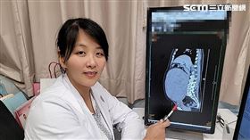 婦人子宮長27公分、7.9公斤肌瘤　竟比雙胞胎大！（圖／長安醫院提供）