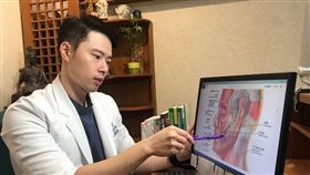 中醫師表示，民眾如果想臉部「微調」，其實除了西醫的醫美整形外，也可透過中醫的「美顏針」，讓臉部曲線看起來更協調。（圖／楊宗翰提供）