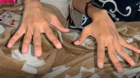 暈針。（圖／翻攝畫面）