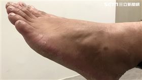 你知道自己的腳年齡嗎？疏忽這些事　36歲卻有60歲的腳（圖／sNug提供）