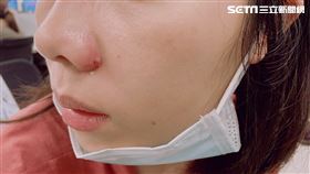 臉部危險三角區（示意圖／資料畫面）