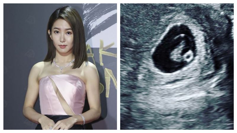突曬胎兒超音波　郭書瑤報喜網嗨爆了