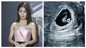 突曬胎兒超音波　郭書瑤報喜網嗨爆了