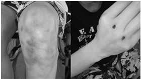 新北市，三重，養護機構，誤傷，受傷，