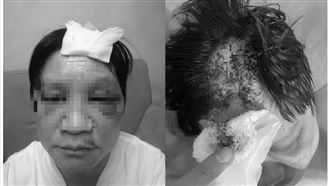 男遭阿姨「強迫坐檯」　被人痛毆成傷