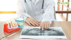 名家專用／NOW健康／徐慶雲指出，門診中的植牙患者，多數是有牙周病的老年人，牙周病往往導致缺牙，且細菌會侵蝕齒槽骨，但並非每顆牙床骨都適合植牙。(勿用)