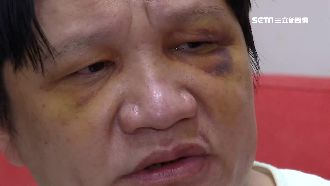 強迫坐檯　客質疑帳單翻倍遭毒打