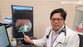 喉嚨有異物感　46歲女誤食藥丸塑膠包裝竟卡食道三周（圖／長安醫院提供）

