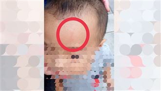 新／男童遭打臉打頭　媽心疼求公道