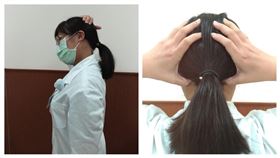 肩頸酸痛／針灸（安南醫院提供）