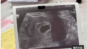 懷孕。（圖／翻攝自廖敬慈醫師臉書）
