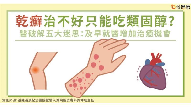 乾癬治不好只吃類固醇？破解五大迷思