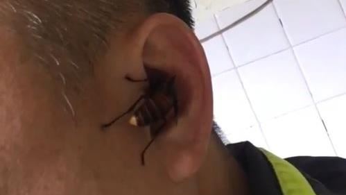 驚！虎頭蜂竟啃人肉　警忍痛撐5分鐘
