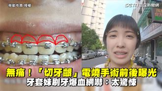 切牙齦前後曝光　她刷牙爆血網：驚悚