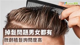 名家專用／NOW健康／FUE微創植髮已經可達到傷口微小、復原期短的需求，患者即使再忙碌，工作排程也能不受影響。(勿用)