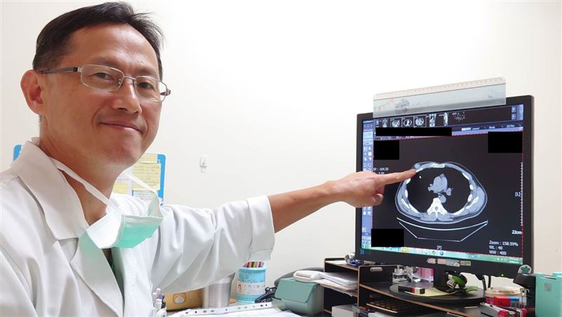 不菸不酒生活正常　男子竟乳癌晚期