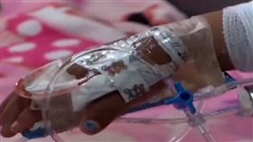 女童遭母親「手綁稻草點火」，手臂嚴重燒爛。 （圖／翻攝自哥查班巴市警局）