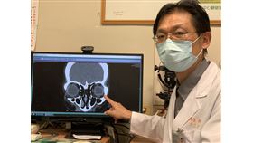 眼睛,後照鏡,風槍