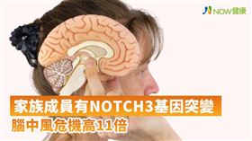 名家專用／NOW健康／台北榮總找出NOTCH3基因破解腦中風基因遺傳之謎，研究團隊發現在NOTCH3基因上的R544C突變是台灣人特有的腦中風基因突變。(勿用)
