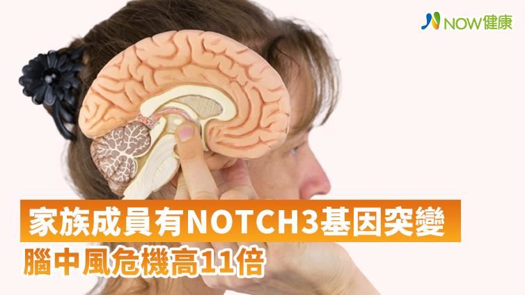 真有腦中風家族　基因突變中風危險高