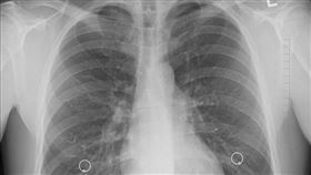 記者陳則凱攝影＋翻攝自pixabay