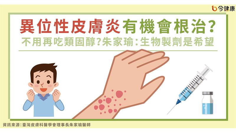 不吃類固醇？異位性皮膚炎可以根治？